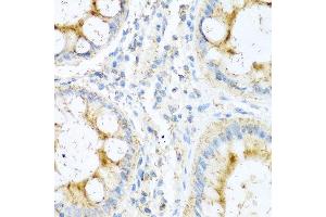Immunohistochemistry of paraffin-embedded human colon using NTF4 antibody at dilution of 1:100 (40x lens).