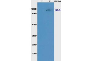 Lane 1: mouse kidney lysates Lane 2: mouse liver lysates probed with Anti NCX1/SLC8A1 Polyclonal Antibody, Unconjugated (ABIN731198) at 1:200 in 4 °C. (SLC8A1 antibody  (AA 801-900))
