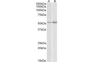 AP21507PU-N Phe Hydoxylase antibody staining of Mouse (A)  and Rat (B) Liver lysate at 0. (Phenylalanine Hydroxylase antibody  (Internal Region))