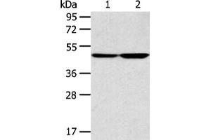 Gel: 8 % SDS-PAGE, Lysate: 40 μg, Lane 1-2: A172 and 293T cell, Primary antibody: ABIN7131322(TEKT4 Antibody) at dilution 1/200 dilution, Secondary antibody: Goat anti rabbit IgG at 1/8000 dilution, Exposure time: 1 minute