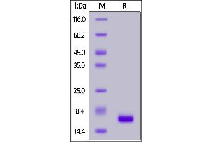 Human IL-21, Tag Free on  under reducing (R) condition. (IL-21 Protein (AA 30-162))