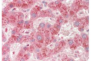 Rabbit Anti-A1BG antibody Catalog Number: ARP33811 Formalin Fixed Paraffin Embedded Tissue: Human Liver Primary antibody Concentration: 1:100 Secondary Antibody: Donkey anti-Rabbit-Cy3 Secondary Antibody Concentration: 1:200 Magnification: 20x Exposure Time: 0. (A1BG antibody  (C-Term))