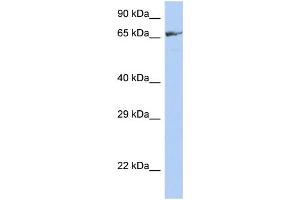 WB Suggested Anti-ZNF676 Antibody Titration:  0. (ZNF676 antibody  (Middle Region))