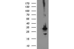 Image no. 4 for anti-Phenylethanolamine N-Methyltransferase (PNMT) antibody (ABIN1500307) (PNMT antibody)