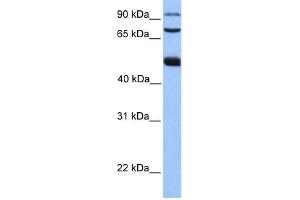 WB Suggested Anti-WDR49 Antibody Titration: 0. (WDR49 antibody  (C-Term))
