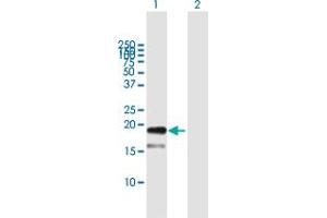 Western Blot analysis of TDGF1 expression in transfected 293T cell line by TDGF1 MaxPab polyclonal antibody. (TDGF1 antibody  (AA 1-188))