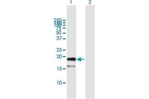 Western Blot analysis of TDGF1 expression in transfected 293T cell line by TDGF1 MaxPab polyclonal antibody.