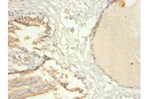 Immunohistochemistry (IHC) image for anti-Tripartite Motif Containing 28 (TRIM28) (AA 22-291) antibody (ABIN7172712)