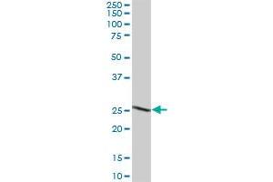 DHRS6 MaxPab polyclonal antibody. (BDH2 antibody  (AA 1-245))