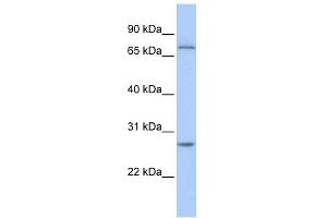 WB Suggested Anti-RCHY1 Antibody Titration:  0. (RCHY1 antibody  (N-Term))
