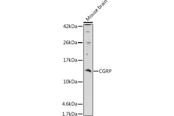 CGRP antibody  (AA 1-141)