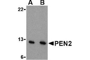 Western Blotting (WB) image for anti-Presenilin Enhancer 2 Homolog (PSENEN) (N-Term) antibody (ABIN1031508) (PEN2 antibody  (N-Term))