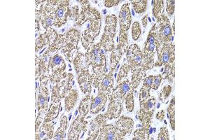 Immunohistochemistry of paraffin-embedded human liver injury using MDH2 Antibody (ABIN1980313) at dilution of 1:100 (40x lens).