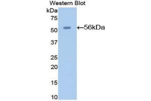 Western blot analysis of the recombinant protein. (AGT antibody  (AA 23-477))
