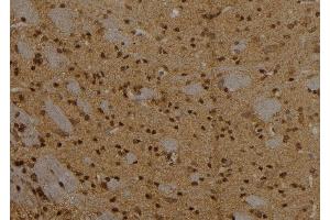 ABIN6257084 and ABIN6273565 at 1/100 staining Rat brain tissue by IHC-P. (CPXCR1 antibody  (N-Term))