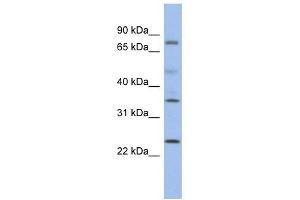PPM1K antibody used at 1 ug/ml to detect target protein.