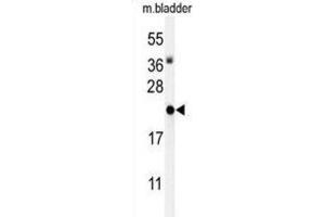 Western Blotting (WB) image for anti-Inhibitor of DNA Binding 4, Dominant Negative Helix-Loop-Helix Protein (ID4) antibody (ABIN3004406) (ID4 antibody)