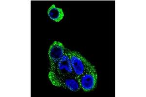 Image no. 2 for anti-Alcohol Dehydrogenase 1B (Class I), beta Polypeptide (ADH1B) (AA 216-245) antibody (ABIN452722) (ADH1B antibody  (AA 216-245))