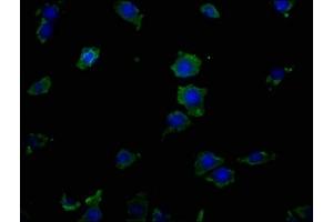 Immunofluorescence staining of SH-SY5Y cells with ABIN7151855 at 1:50, counter-stained with DAPI. (EPH Receptor A8 antibody  (AA 45-249))