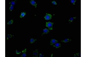 Immunofluorescence staining of SH-SY5Y cells with ABIN7151855 at 1:50, counter-stained with DAPI.