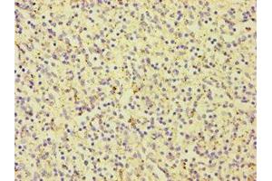 Immunohistochemistry of paraffin-embedded human spleen tissue using ABIN7146924 at dilution of 1:100 (CARD9 antibody  (AA 237-536))