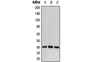 Western blot analysis of CD32b (pY292) expression in MCF7 pervanadate-treated (A), mouse liver (B), PC12 pervanadate-treated (C) whole cell lysates. (FCGR2B antibody  (C-Term, pTyr292))