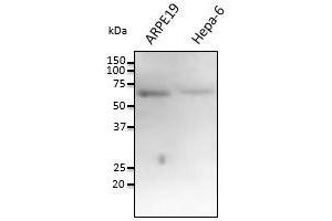 Anti-FTCO Ab at 1/1,000 dilution,at 100 Iane, Rabbit polyclonal to goat lgG (HRP) at 1/10,000 dilution, (FTCD antibody  (N-Term))