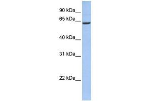 WB Suggested Anti-CCDC67 Antibody Titration: 0. (CCDC67 antibody  (N-Term))