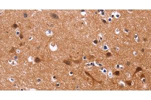 Immunohistochemistry of paraffin-embedded Human brain tissue using MSH4 Polyclonal Antibody at dilution 1:30