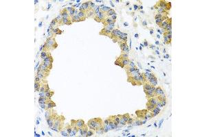 Immunohistochemistry of paraffin-embedded mouse lung using WNT5B antibody at dilution of 1:100 (40x lens).