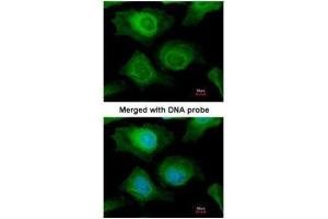ICC/IF Image Immunofluorescence analysis of paraformaldehyde-fixed HeLa, using AKR1B10, antibody at 1:200 dilution. (AKR1B10 antibody)