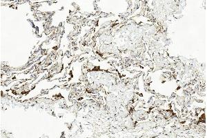 Immunohistochemical analysis of paraffin-embedded Human lung section using Pink1 am1851b. (LAMP2 antibody)