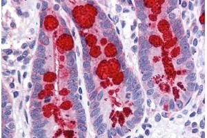 Human Small Intestine: Formalin-Fixed, Paraffin-Embedded (FFPE) (SLC9A3R1 antibody  (AA 252-359))