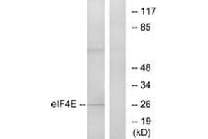 Western blot analysis of extracts from NIH-3T3 cells, treated with FBS, using eIF4E (Ab-209) Antibody.
