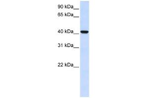 DGAT2L4 antibody used at 1 ug/ml to detect target protein. (AWAT2 antibody  (C-Term))