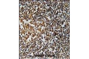 PYHIN1 Antibody (N-term) (ABIN651569 and ABIN2840306) immunohistochemistry analysis in formalin fixed and paraffin embedded human lymph tissue followed by peroxidase conjugation of the secondary antibody and DAB staining. (PYHIN1 antibody  (N-Term))