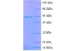 SDS-PAGE (SDS) image for Doublecortin (DCX) (AA 1-361), (full length) protein (His tag) (ABIN1095575) (Doublecortin Protein (DCX) (AA 1-361, full length) (His tag))