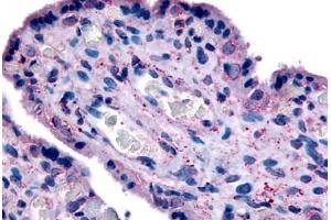 Human Placenta (formalin-fixed, paraffin-embedded) stained with SLC7A5 antibody ABIN213435 at 20 ug/ml followed by biotinylated goat anti-rabbit IgG secondary antibody ABIN481713, alkaline phosphatase-streptavidin and chromogen. (SLC7A5 antibody  (N-Term))