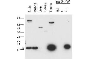 Image no. 1 for anti-Selenoprotein W, 1 (SEPW1) antibody (ABIN401399) (Selenoprotein W antibody)