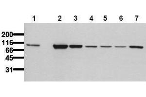 Western Blotting (WB) image for anti-Catenin (Cadherin-Associated Protein), beta 1, 88kDa (CTNNB1) (Exon 2), (N-Term) antibody (ABIN126745) (CTNNB1 antibody  (Exon 2, N-Term))