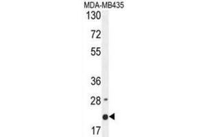 Western Blotting (WB) image for anti-Membrane-Spanning 4-Domains, Subfamily A, Member 4 (MS4A4A) antibody (ABIN2995855)