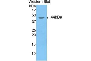 Detection of Recombinant ARRb2, Human using Polyclonal Antibody to Arrestin Beta 2 (ARRb2) (Arrestin 3 antibody  (AA 262-430))