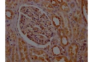 IHC image of ABIN7127782 diluted at 1:100 and staining in paraffin-embedded human kidney tissue performed on a Leica BondTM system. (Recombinant PTGER2 antibody)