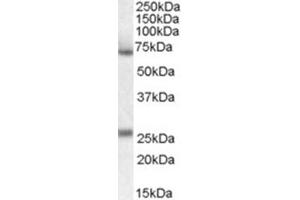 Image no. 2 for anti-Alpha2 Antiplasmin (SERPINF2) (Internal Region) antibody (ABIN375144) (alpha 2 Antiplasmin antibody  (Internal Region))