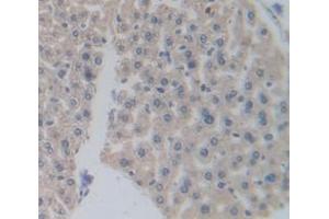 Figure. (PPARD antibody  (AA 29-147))