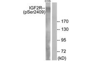 Western blot analysis of extracts from COS7 cells treated with UV 15', using IGF2R (Phospho-Ser2409) Antibody. (IGF2R antibody  (pSer2409))