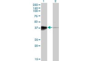Western Blot analysis of HOXB5 expression in transfected 293T cell line by HOXB5 monoclonal antibody (M01), clone 3F10.