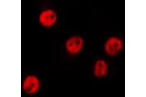 ABIN6275790 staining HepG2 by IF/ICC. (CSRNP3 antibody  (Internal Region))