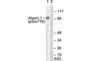Western blot analysis of extracts from HepG2 cells treated with Adriamycin 0. (Ataxin 1 antibody  (pSer776))