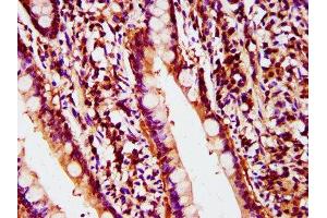 Immunohistochemistry (IHC) image for anti-Polymerase (DNA Directed), delta 2, Accessory Subunit (POLD2) (AA 245-430) antibody (ABIN7150231)